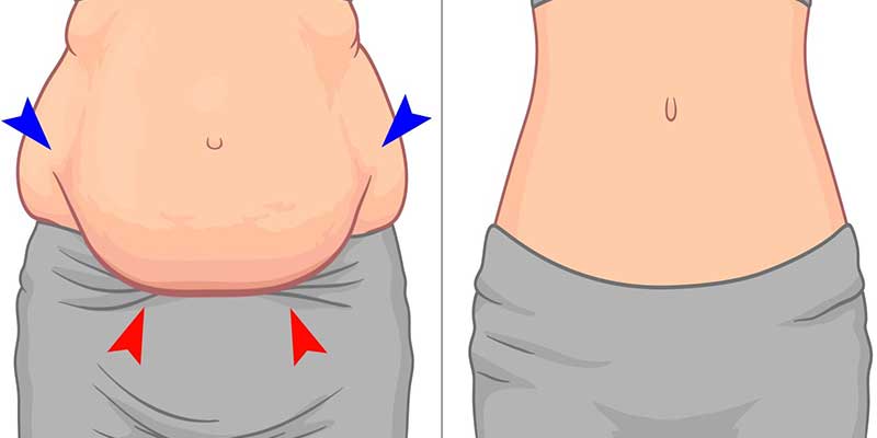 Losing Belly Fat Without Exercise