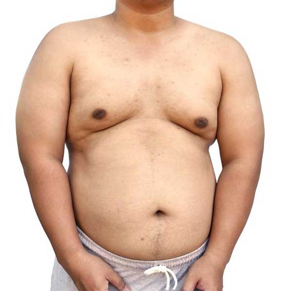 Difference Between Brown and White Fat